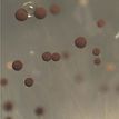 Small brown balls in grey background, representing Aspergillus niger stereomicroscopy