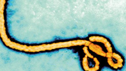 Ebola virus
