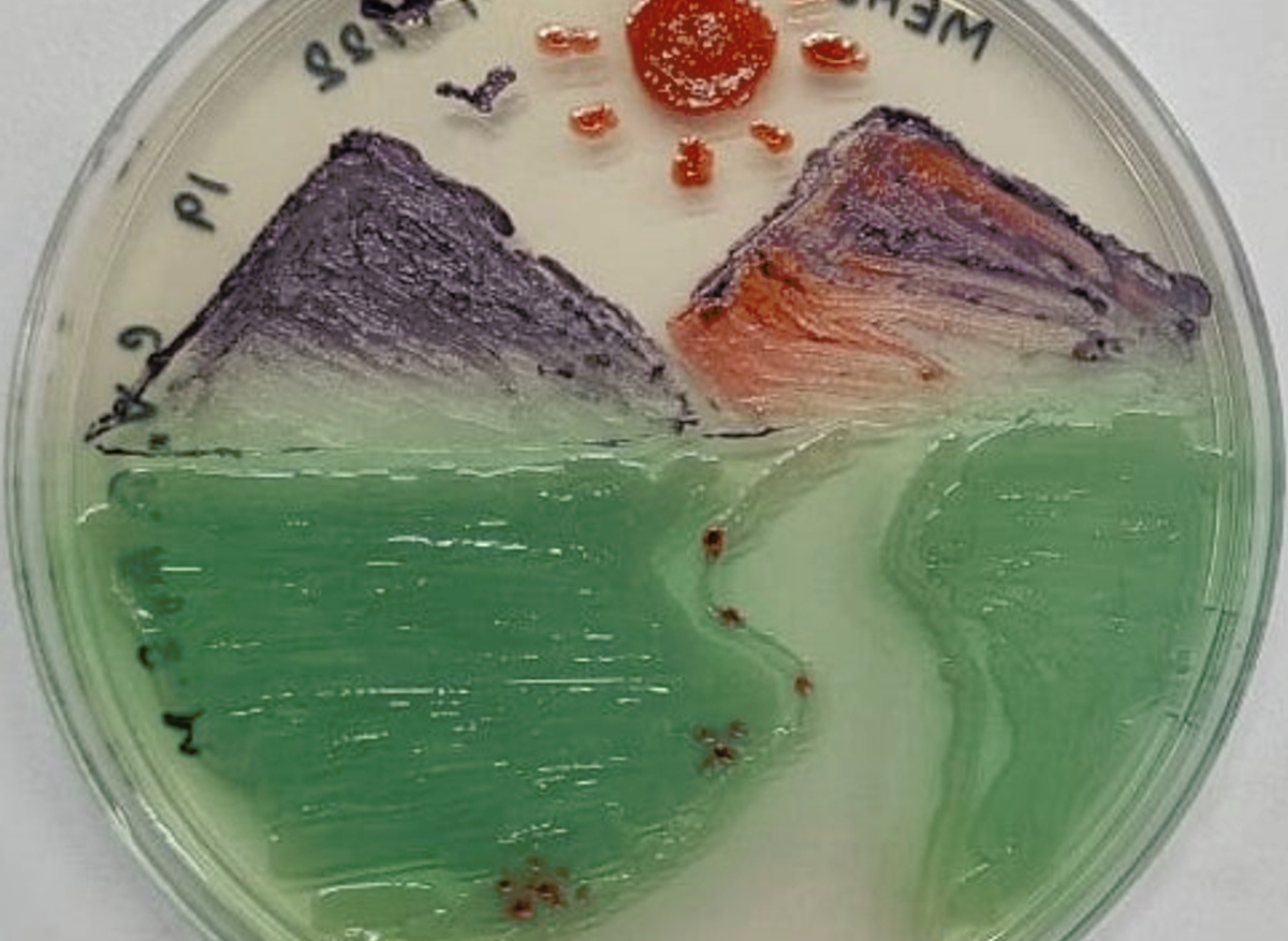 Agar art plate 3