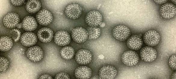 Electron Microscopy of Rotavirus.png