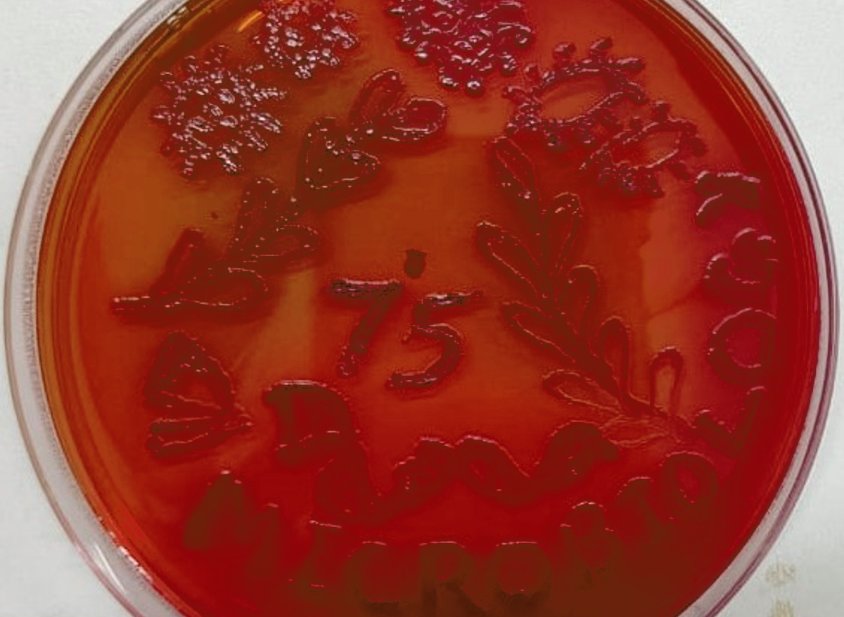 Agar art plate 4