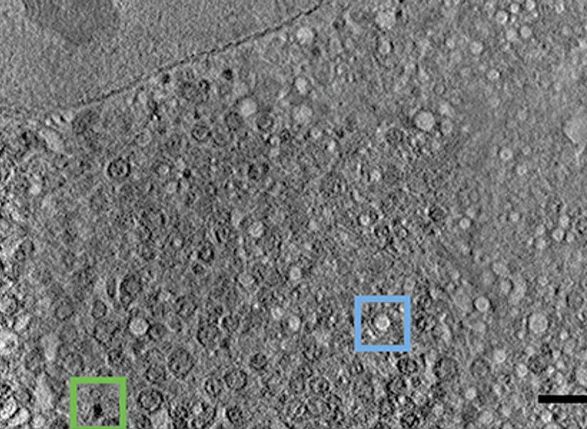 CryoSXT of an intact mammalian cell expressing mutant huntingtin. Credit: Michele Darrow