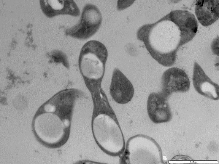 Methylocystis parvus BRCS2 methanotroph bacteria showing PHB bioplastic deposits as the white spots