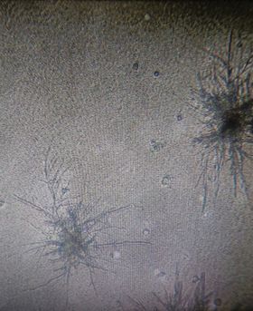 Microscopic image of cells.