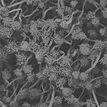 Microscopic image of grey-coloured microbes.