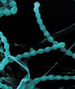 Blue abstracts beaded strings on a black background