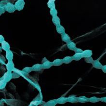 Blue abstracts beaded strings on a black background