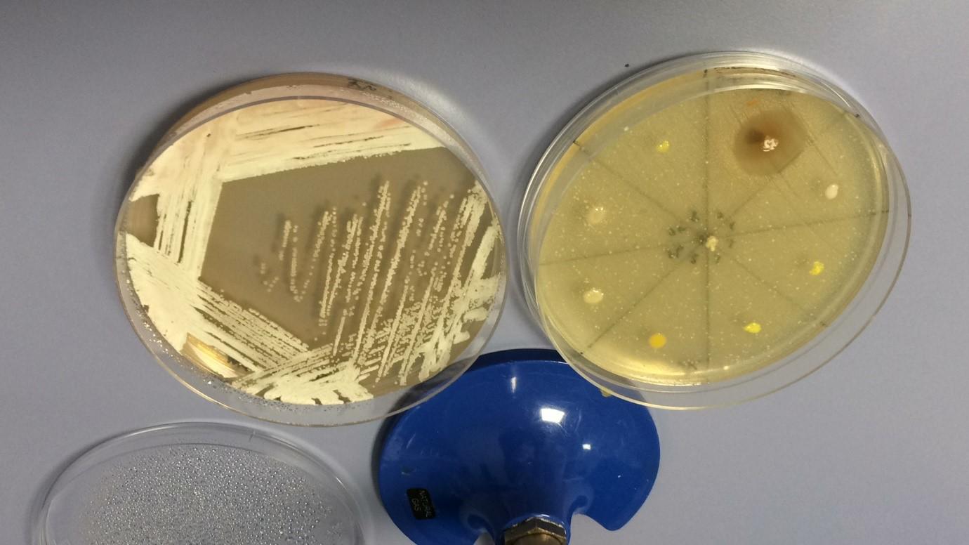 Screening bacteria for antimicrobial resistance in the lab