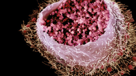 MT May 2013 Chlamydia2