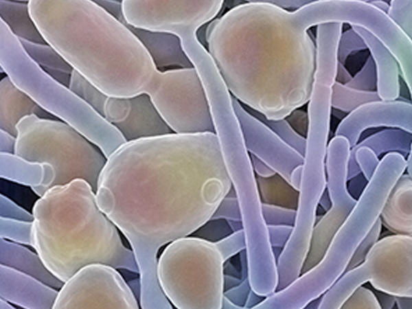 Hongos | ¿Qué es la microbiología? | Sociedad de Microbiología