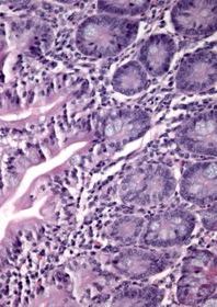 Purple-stained microscopic tissue sample showing cellular structures and patterns