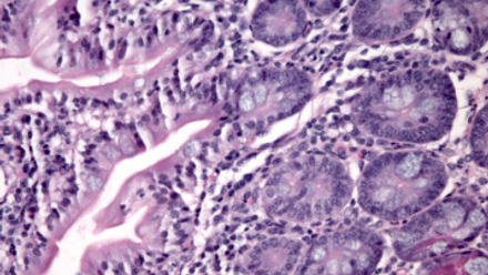 Purple-stained microscopic tissue sample showing cellular structures and patterns