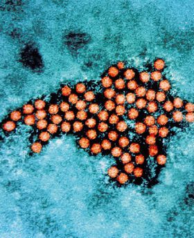 Microscopic image of a cluster of orange virus particles on a blue background.