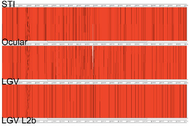 MT May 2013 Chlamydia 2