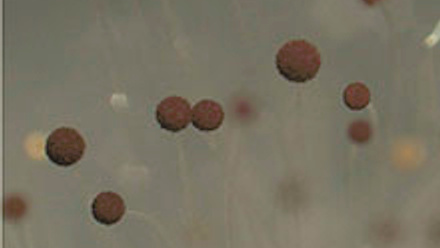 Small brown balls in grey background, representing Aspergillus niger stereomicroscopy