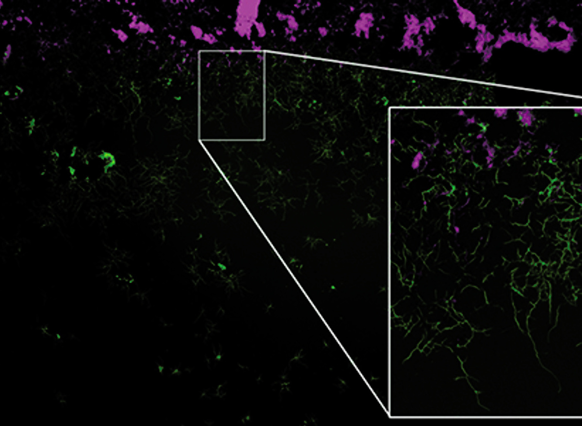 Mesolens image of a Streptomyces coelicolor (M145) mycelium obtained using a high-resolution camera. Credit: Liam Rooney