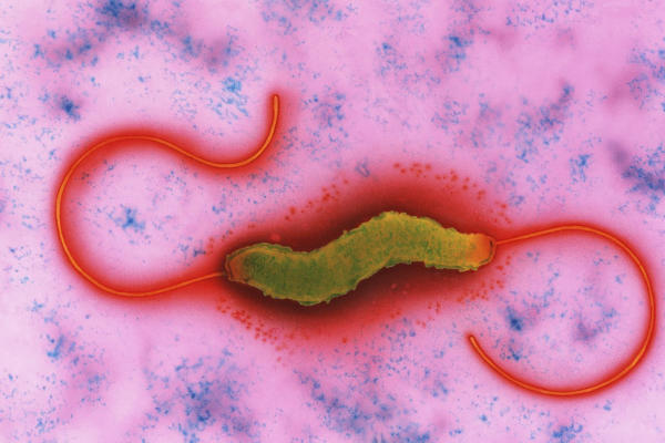 food-poisoning-bacteria