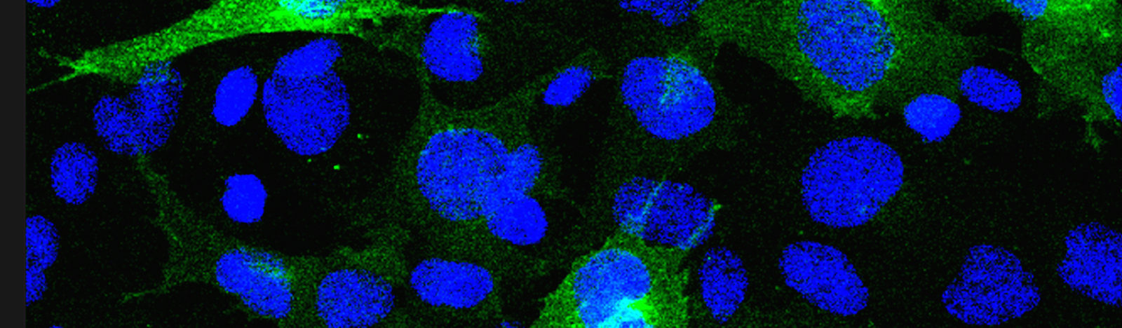 Bluetongue virus-infected sheep cells