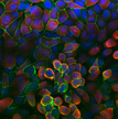 changes triggered by SARS-CoV-2 infection in lung-on-chip alveoli cells Image by Tanja Suligoj and Catherine Booth Quadram Institute.png 1