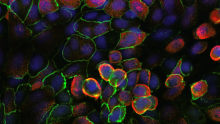 changes triggered by SARS-CoV-2 infection in lung-on-chip alveoli cells Image by Tanja Suligoj and Catherine Booth Quadram Institute.png 1