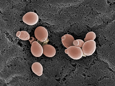Microscopic image of Candida fungi.