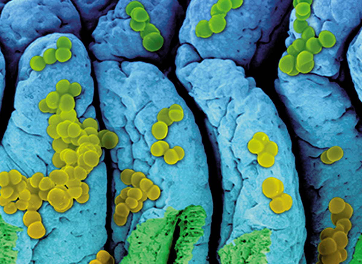 Coloured scanning electron micrograph of Staphylococcus aureus bacteria on the surface of small intestine villi. Credit: Dennis Kunkel Microscopy/SPL