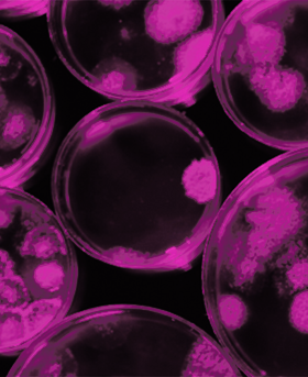 A collection of petri dishes growing micro-organisms