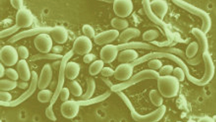 MT Nov 2012 7 Article Gow Candida