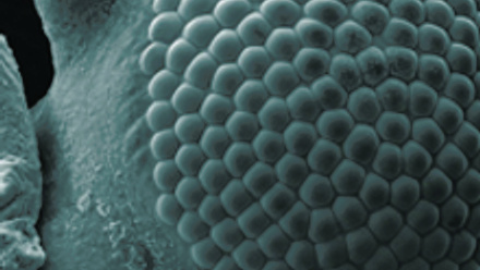 MT Aug 2015 comment greenfly eye