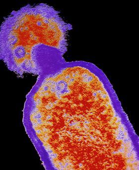 Coloured electron microscope image of a bacteriophage virus.