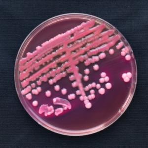 bacteria-culture-picture-id641213636.jpg