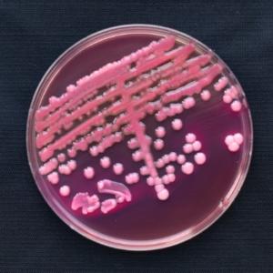 pseudomonas bacteria