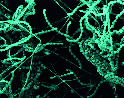 Bacteria filaments