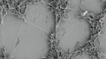 MT Nov 2015 campylobacter biofilm plastic surface