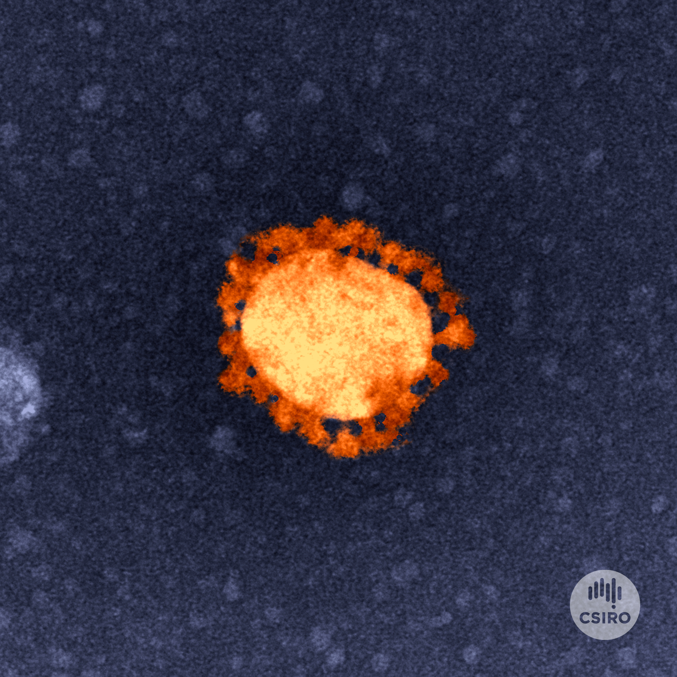 COVID-19-JEM1400--16-orange-blu-vibrant-300-dpi_Credit-CSIRO.jpg