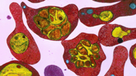 Malaria cell representation