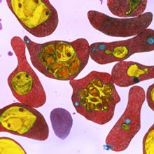 Malaria cell representation