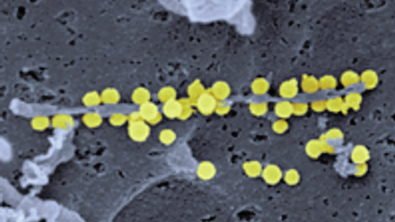 Crimean-Congo haemorrhagic fever virus (CCHFV)