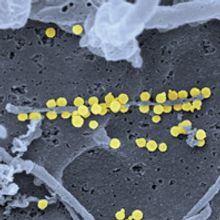 Crimean-Congo haemorrhagic fever virus (CCHFV)