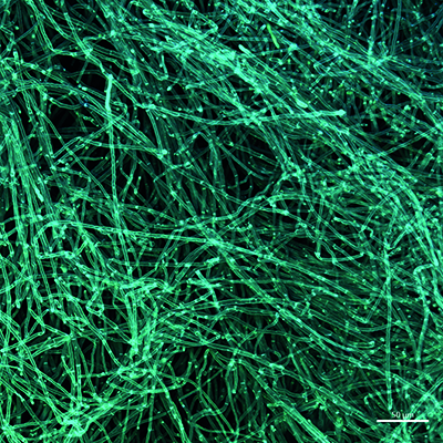 Tangled green fibers.