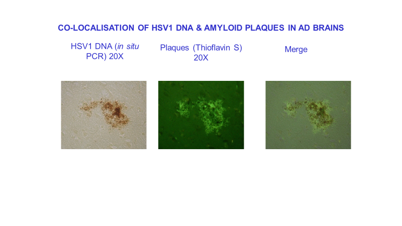 co-localisation of hsv1.png