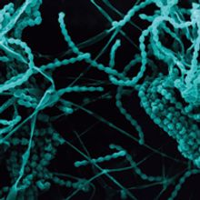 Bacteria filaments