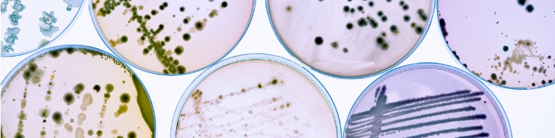 mixed-of-bacteria-colonies-and-fungus-in-various-petri-dish-picture-id1253036731.jpg