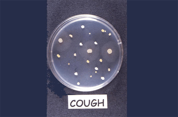 A cough that was aimed directly onto nutrient agar