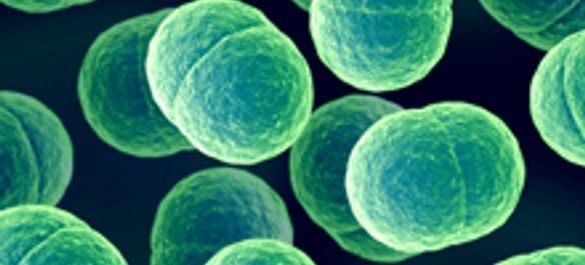 Prokaryotic cells