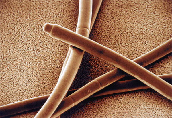 MT Feb 2014 Lyngbya_blue-green_alga-SPL