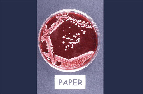 Een streepjesplaat om afzonderlijke kolonies van een specifieke bacterie te isoleren