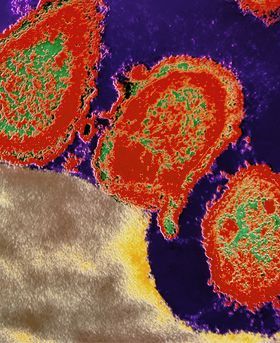 Microscopic image showing multiple red stains on a dark background.