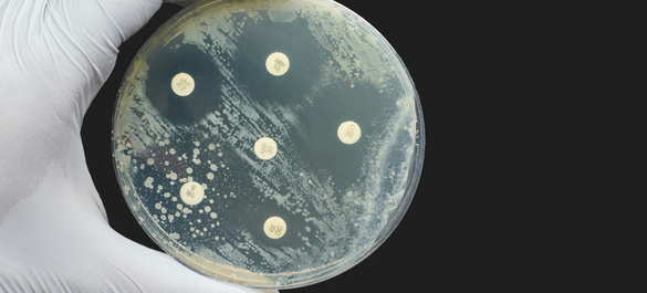 Petri-dish testing for Antimicrobial Susceptibility testing.