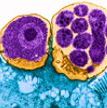 news-cryptosporidium-thumbnail.jpg